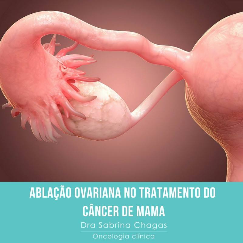 Câncer de mama: ablação ovariana